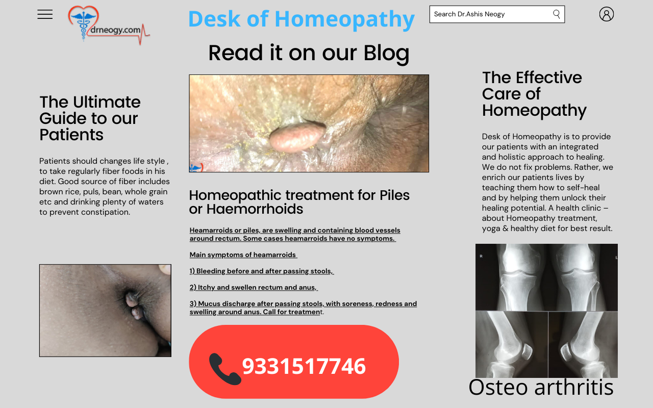 Best treatment in Homeopathy 
